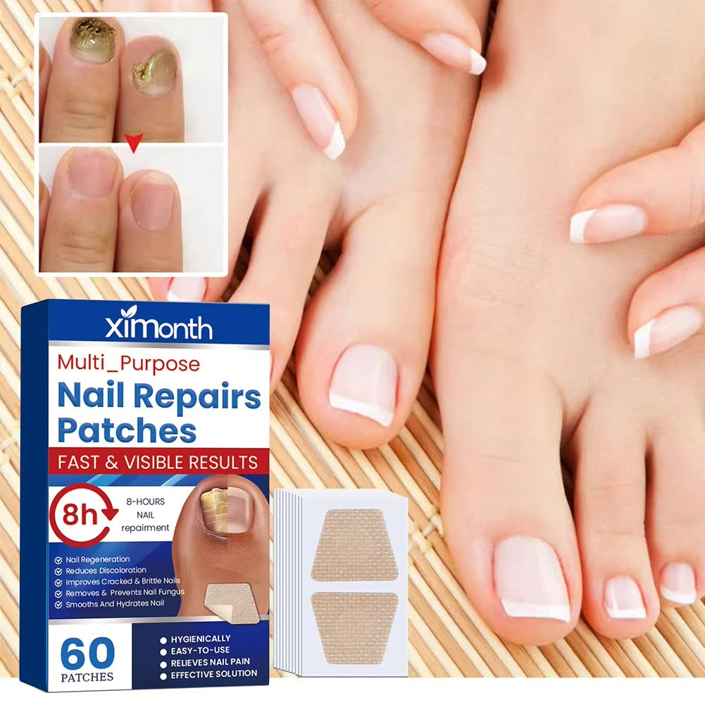 Επιθέματα επανόρθωσης νυχιών Nail Nurture™ κατά της μυκητίασης των νυχιών