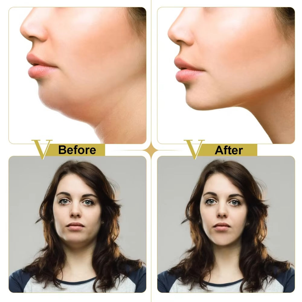 Μάσκες σύσφιξης ContourLift V